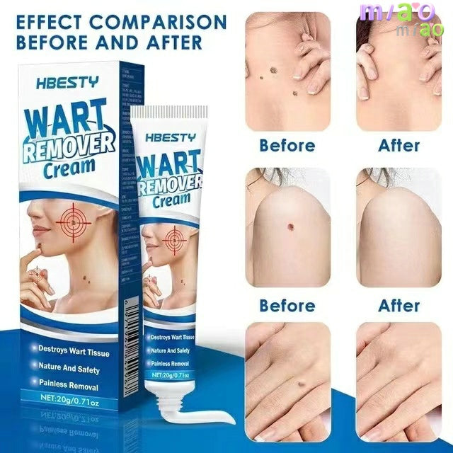 Skin Tag Remover Cream Painless Mole Skin Dark Spot Warts Remover Serum Freckle Face Wart Tag Treatment Removal Essential Oil TIANTIAN LIFE Market Place