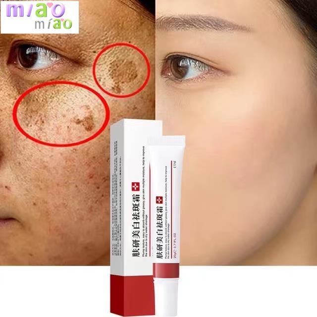Whitening Freckle Cream Remove Dark Spots Remove Melasma Anti Freckle Cream Fade Pigmentation Skin Anti-Aging Skin Light TIANTIAN LIFE Market Place